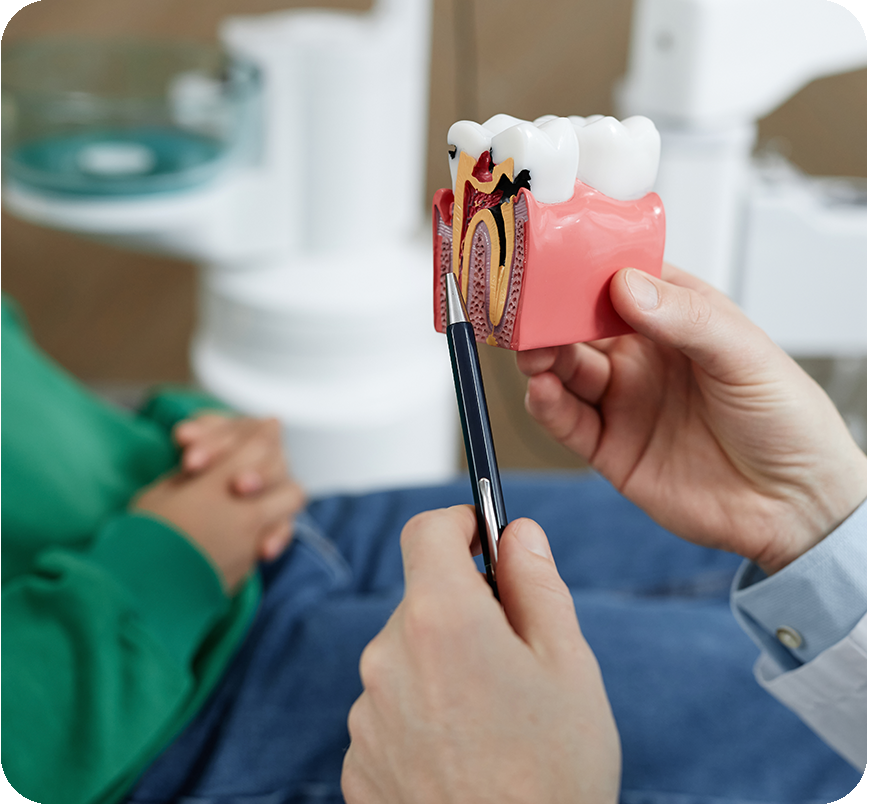 Root Canal Treatment