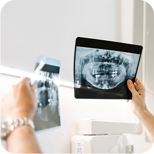 Root Canal Treatment - Examination