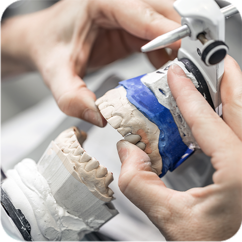 Dental Onlay & Crowns