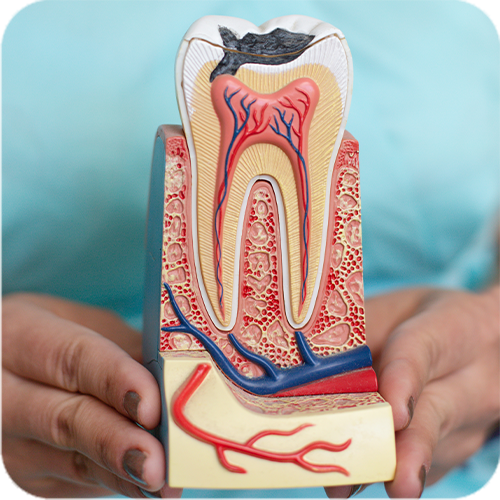 Root Canal Treatment