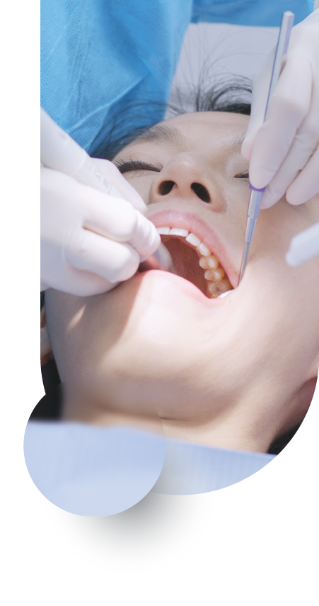 Root Canal Treatment